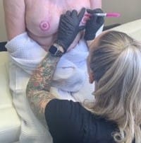 Do areola restoration tattoos hurt?