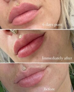 timeline of lip blush tattoo healing daela cosmetic tattoo