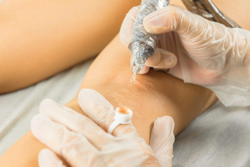 Scar Camouflage Training