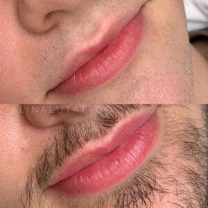 Hide Scars on Your Lip! Powerful Way to Conceal Scars!