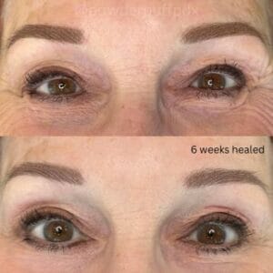 The Art of Patience: Navigating the Brow Shock Journey