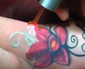 Tattoo Removal: What's the Best Way?