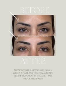 Permanent Makeup Tattoo Removal at DAELA Portland