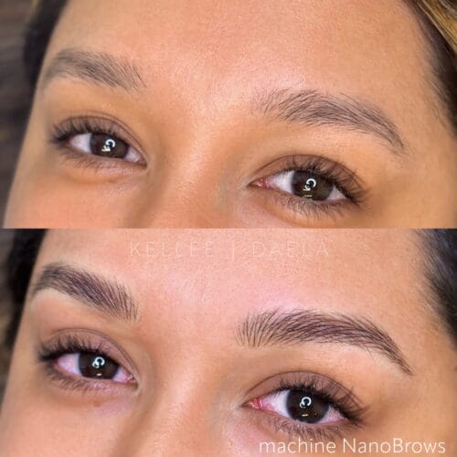 Hydration: Essential Part of Permanent Cosmetic Results