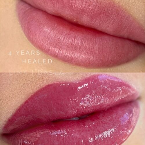 Healed Lip Blush Tattoo Daela Cosmetic Tattoo
