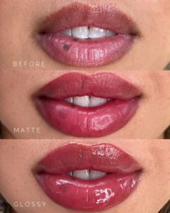 Lip Blush tattoo in Very Berry at DAELA Cosmetic Tattoo