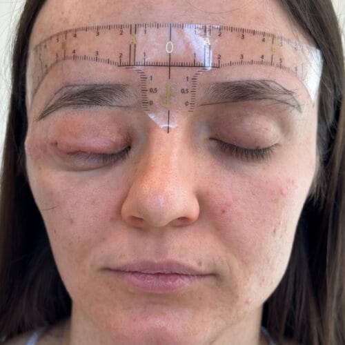 Restorative Cosmetic Tattoo: Enhancing Symmetry with Nano Brows