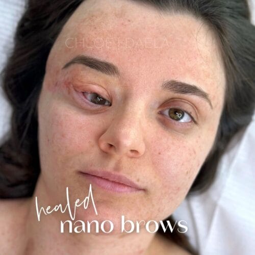 Paramedical Cosmetic Tattoo by Chloe at DAELA Cosmetic Tattoo Scottsdale