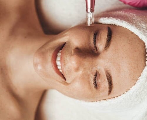 Microneedling at DAELA Cosmetic Tattoo