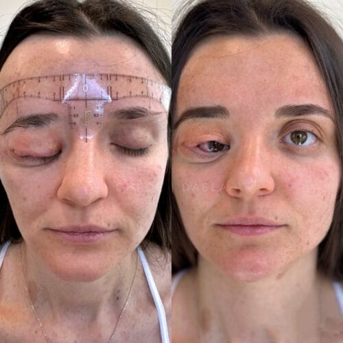 Before and After of Paramedical cosmetic tattoo at DAELA Scottsdale