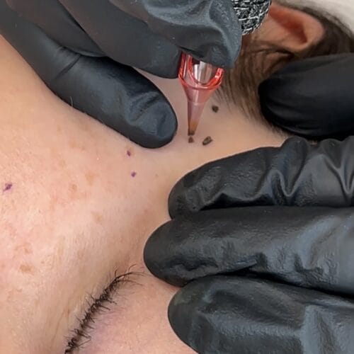 Faux Freckles at Daela Scottsdale