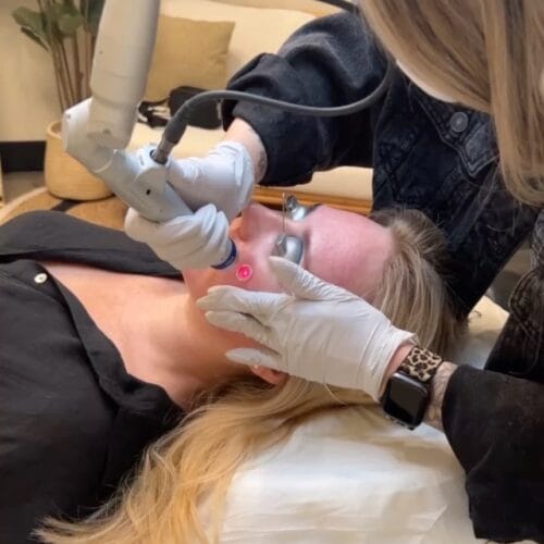 Laser Skin Treatments for Every Age