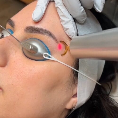 Laser Skin Treatments at DAELA