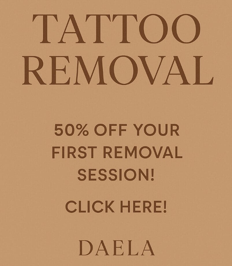 laser tattoo removal discount
