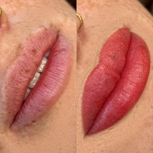 Lip Blush Tattoo for Melanin-Rich Lip Neutralization
