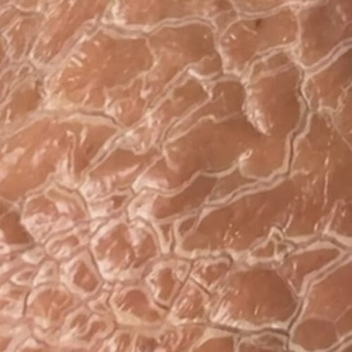 DMK Enzyme Therapy at DAELA Scottsdale