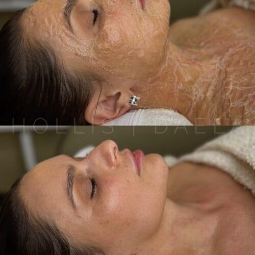 DMK Enzyme Therapy at DAELA Scottsdale