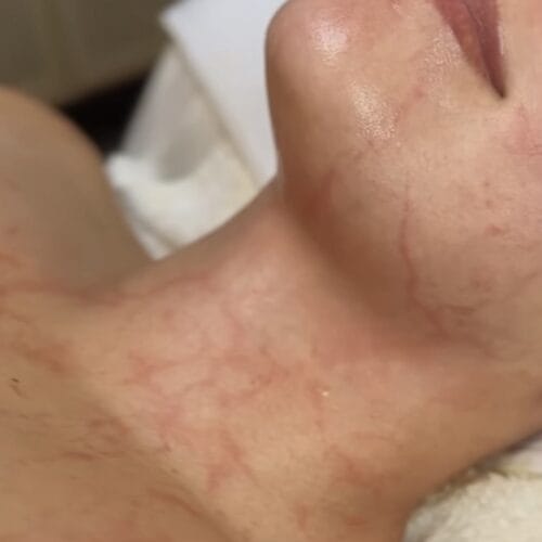 DMK Enzyme Therapy at DAELA Scottsdale