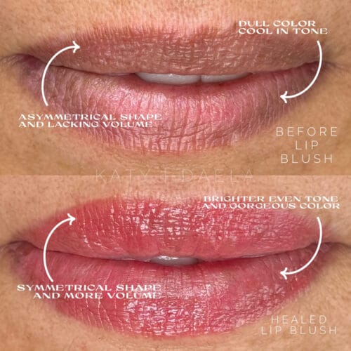 Lip Neutralization for Melanin-Rich Skin by Katy Rice of DAELA Scottsdale