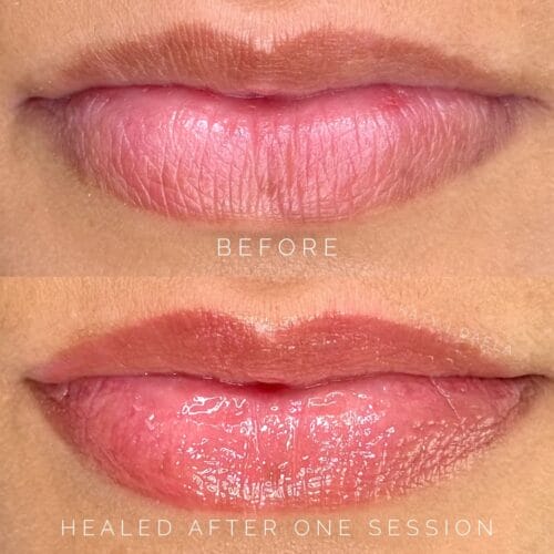 Lip Neutralization for Melanin-Rich Skin by Katy Rice of DAELA Scottsdale