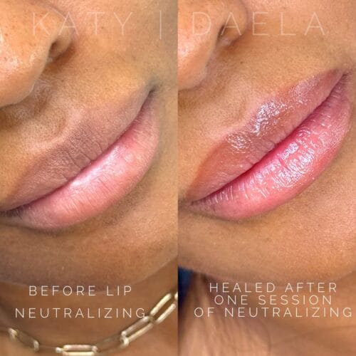 Lip Neutralization for Melanin-Rich Skin