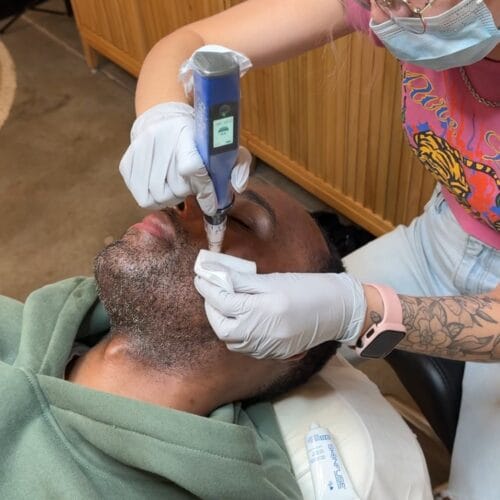 The Truth About Laser & Melanin-Rich Skin