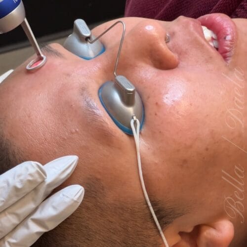 Melanin Rich Skin laser Treatments at DAELA Scottsdale