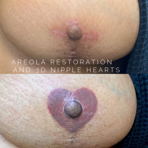 Heart Areola Restoration Tattoo