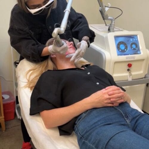 Laser Facials at DAELA Portland