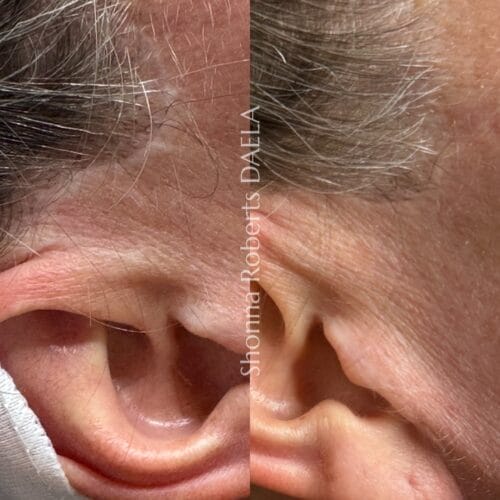 Scar Camouflage in Portland at DAELA by Shonna