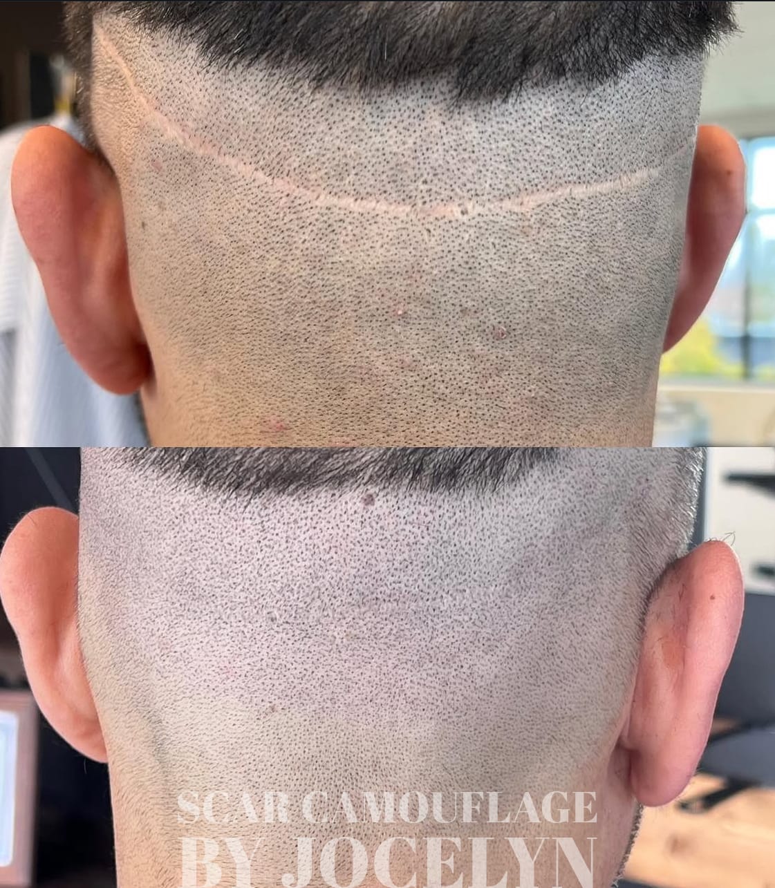 paramedical-tattooing-portland-scalp-micropigmentation Paramedical Tattooing in Portland OR at DAEALA