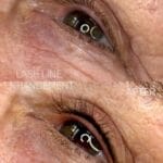 Mens lash line Enhancement