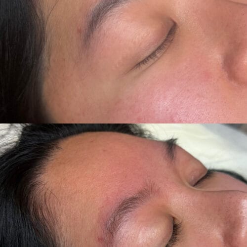 PMU Removal DAELA Portland