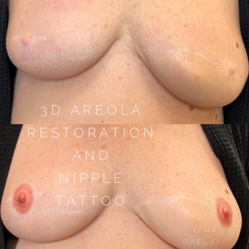 Areola Restoration Tattoo in Portland at DAELA by Lina