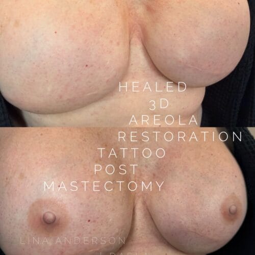Areola Restoration Tattoo in Portland at DAELA by Lina