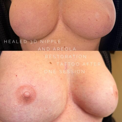 Areola Restoration Tattoo in Portland at DAELA by Lina