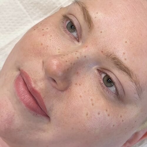 Freckles DAELA Cosmetic Tattoo Scottsdale- Chloe
