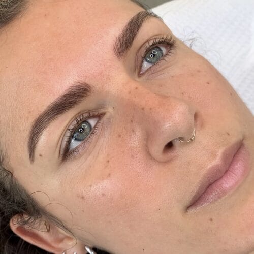 Freckles & Beauty Marks DAELA Scottsdale