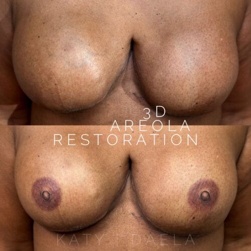 Areola Restoration Tattoo in Scottsdale at DAELA by Katy