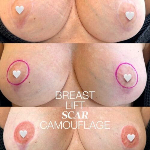 Areola Restoration Tattoo at DAELA Scottsdale