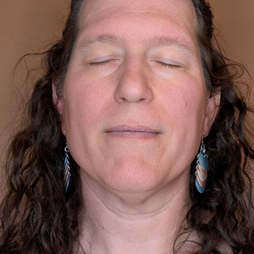 Before a laser facial in scottsdale daela