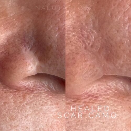 Scar Camouflage DAELA Scottsdale