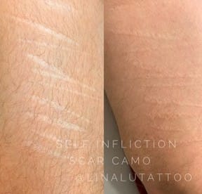 Scar Camouflage DAELA Scottsdale