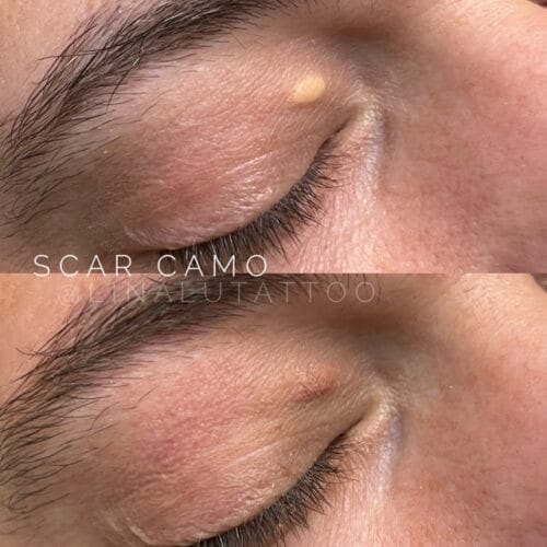 Scar Camouflage DAELA Scottsdale