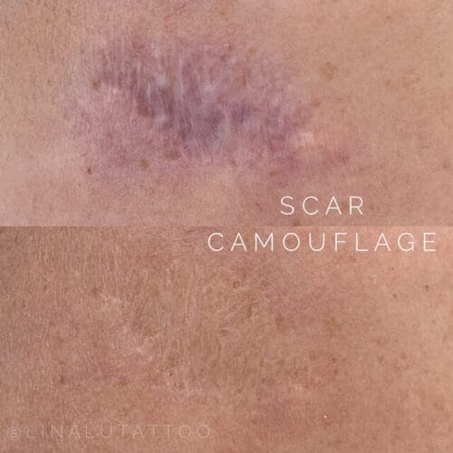 Scar Camouflage tattoo in Scottsdale at DAELA