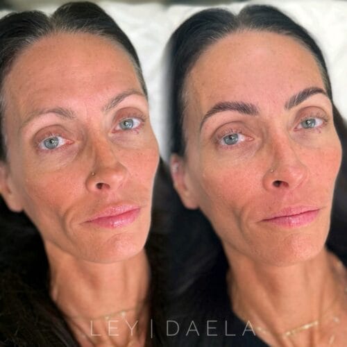 Brow lamination in Scottsdale at DAELA