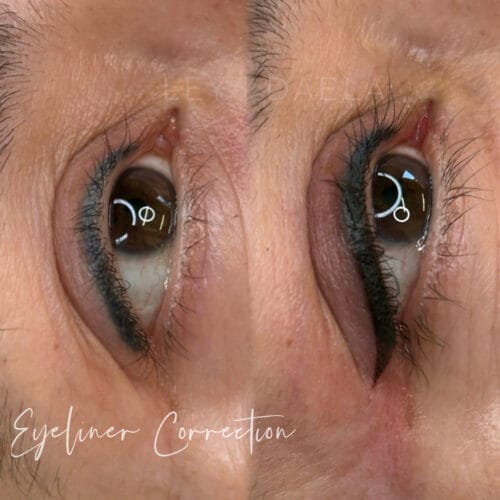 Eyeliner tattoo Correction Daela Scottsdale