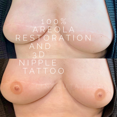 Areola Restoration Tattoo Vancouver DAELA Lina