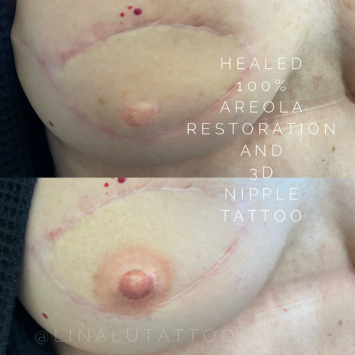 Areola Restoration Tattoo Vancouver DAELA Lina