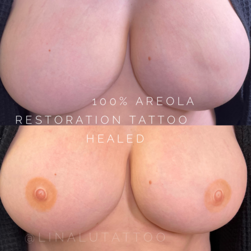 Areola Restoration Tattoo Vancouver DAELA Lina